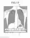 Fig. 17 - Radiation image display apparatus and radiation imaging system
