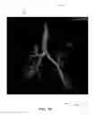 Fig. 20 - Apparatuses and methods for navigation in and local segmentation extension of anatomical treelike structures