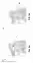 Fig. 02 - Vertex split connectivity prediction for improved progressive mesh compression