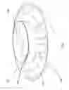 Fig. 06 - APPARATUS FOR REMOVING AND INSTALLING ELEVATED LIGHT BULBS