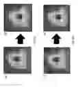 Fig. 09 - Method and system for correcting focus location in magnetic resonance guided focused ultrasound surgery