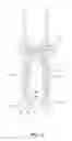 Fig. 04 - Graft suspension device