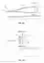 Fig. 06 - Graft suspension device