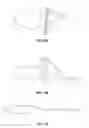 Fig. 09 - Graft suspension device