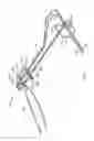 Fig. 02 - Surgical fastening