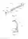 Fig. 09 - Surgical stapler with anvil seating detection