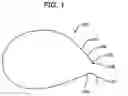 Fig. 02 - Barbed suture having increased holding strength