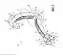 Fig. 02 - Ligation clip with retention features