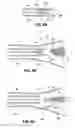 Fig. 07 - METHODS AND DEVICES FOR THE TREATMENT OF PULMONARY DISORDERS