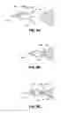 Fig. 09 - METHODS AND DEVICES FOR THE TREATMENT OF PULMONARY DISORDERS