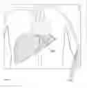 Fig. 10 - Methods and systems for performing navigation-assisted medical procedures