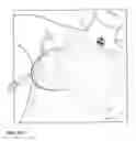 Fig. 19 - Methods and systems for performing navigation-assisted medical procedures