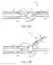 Fig. 09 - Surgical instrument with dual mode articulation drive