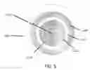 Fig. 09 - Fully integrated, disposable tissue visualization device