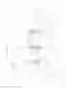 Fig. 43 - REVISABLE ANTERIOR CERVICAL PLATING SYSTEM