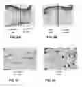 Fig. 08 - Selective fat removal using photothermal heating