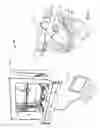 Fig. 02 - Dental devices and methods for treating one or more teeth