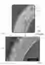 Fig. 02 - VASCULAR GRAFTS AND METHOD FOR PRESERVING PATENCY OF THE SAME