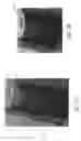 Fig. 06 - VASCULAR GRAFTS AND METHOD FOR PRESERVING PATENCY OF THE SAME