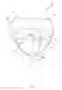 Fig. 07 - FLEXIBLE HEART VALVE PROSTHESIS