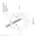 Fig. 49 - Methods and systems for delivering prostheses using rail techniques