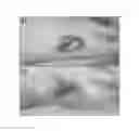 Fig. 01 - Compositions for the treatment of ischemic ulcers and stretch marks