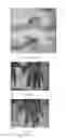 Fig. 02 - Compositions for the treatment of ischemic ulcers and stretch marks