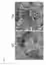 Fig. 06 - Compositions and methods for the treatment of lysosomal storage disorders and disorders characterized by lysosomal dysfunction