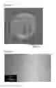 Fig. 02 - Therapeutic agent for hyperphosphatemia