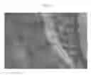 Fig. 07 - Methods and compositions to facilitate repair of avascular tissue