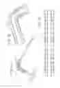 Fig. 07 - Compact Urinary Catheter With Pre-Attached Collection Bag