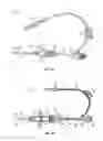 Fig. 02 - Catheter system with remote instrument delivery
