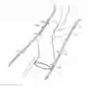 Fig. 01 - Methods for placing a stent-graft to cover collateral vessels in lower extremity vasculature