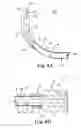 Fig. 06 - Sinus dilation system and method