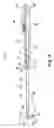 Fig. 09 - Sinus dilation system and method