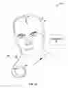 Fig. 02 - Electrode structure for implantable medical leads