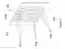 Fig. 02 - Wearable multiphasic cardioverter defibrillator system and method