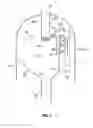 Fig. 03 - NEW DEVICE FOR GAS-LIQUID SEPARATION, INTENDED FOR THREE-PHASE FLUIDISED BED REACTORS SUCH AS THOSE USED IN THE H-OIL PROCESS