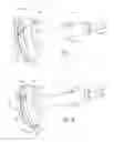 Fig. 03 - Front final gear assembly to propshaft clipping structure and installation method