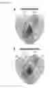 Fig. 08 - MEANS AND METHODS FOR THE GENERATION OF OLIGODENDROCYTES