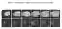 Fig. 16 - Stem Cells from the Mammalian Neural Plate