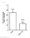 Fig. 02 - SiRNA structures for high activity and reduced off target