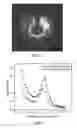 Fig. 02 - Diagnostic System and Process for Rapid Bacterial Infection Diagnosis