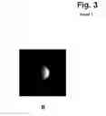 Fig. 08 - Image forming cytometer