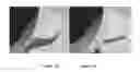 Fig. 08 - DEVICE TO PROVIDE STIFFNESS AND HANG FOR A KNITTED NECK
