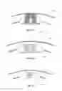 Fig. 19 - Compressible damping system for body part protection