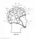 Fig. 22 - Compressible damping system for body part protection