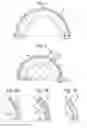 Fig. 02 - Helmet