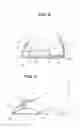 Fig. 05 - Orthotic Device