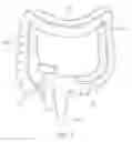 Fig. 02 - COLONOSCOPE HANDLE ATTACHMENT DEVICE